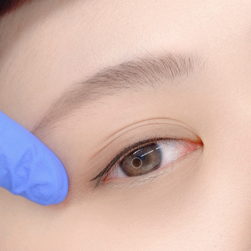 A closer look at eye definition