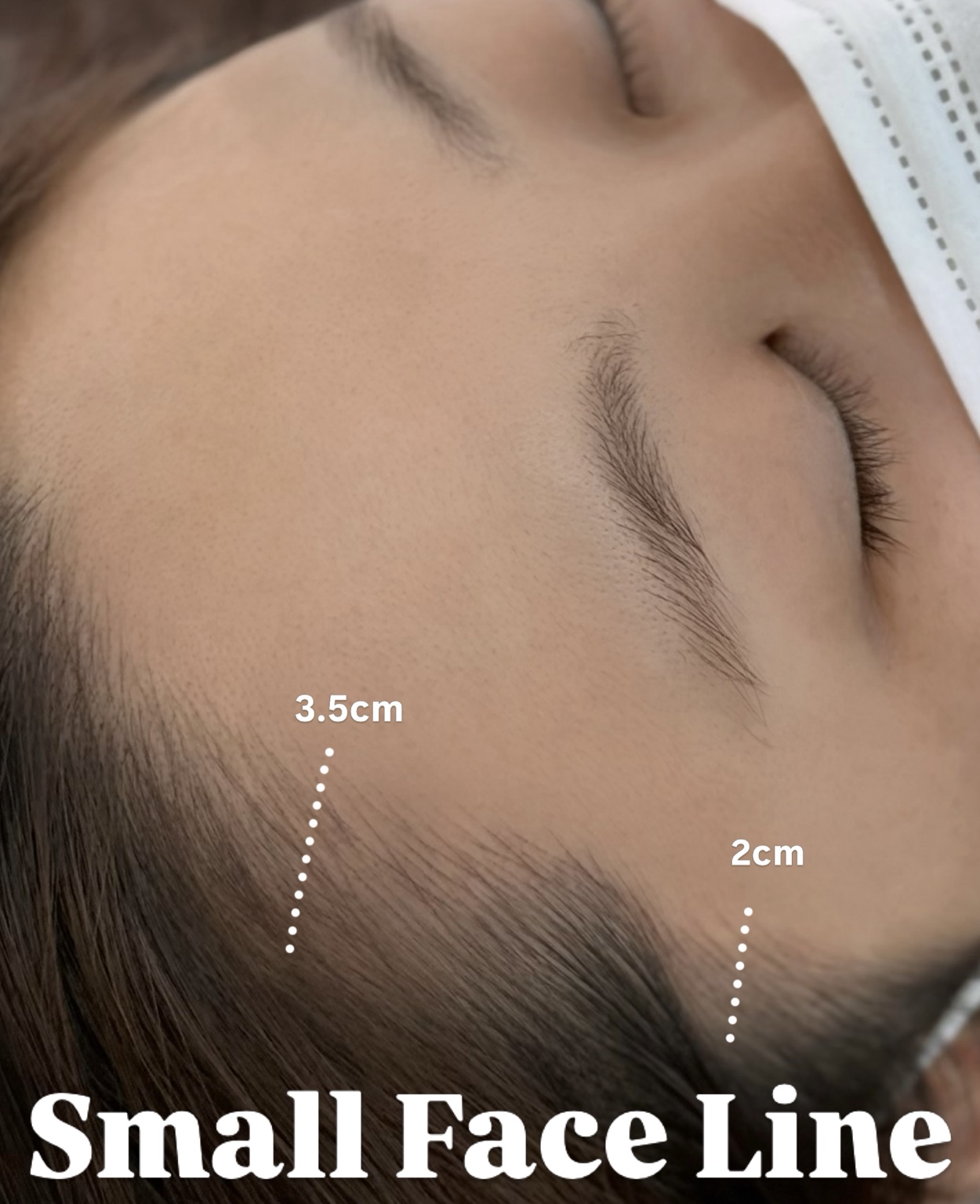 Hairline design · Detail